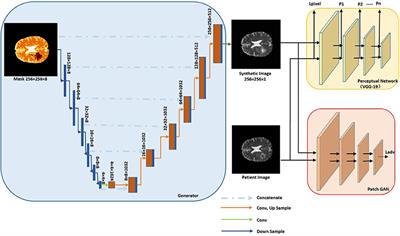 Improvement of Multiparametric MR Image Segmentation by Augmenting the Data With Generative Adversarial Networks for Glioma Patients